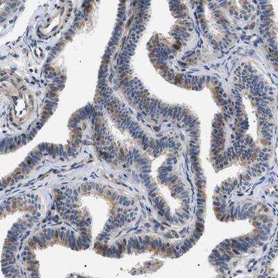 Immunohistochemistry-Paraffin: KIAA0355 Antibody [NBP1-90943]