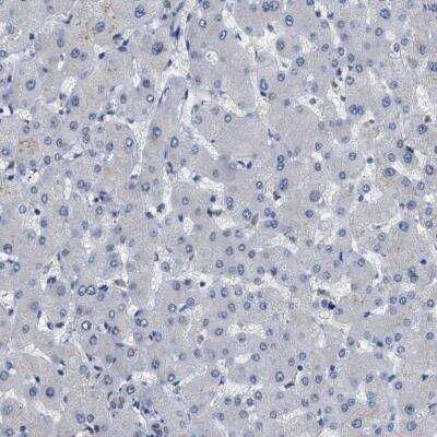Immunohistochemistry-Paraffin: KIAA0355 Antibody [NBP1-90943]