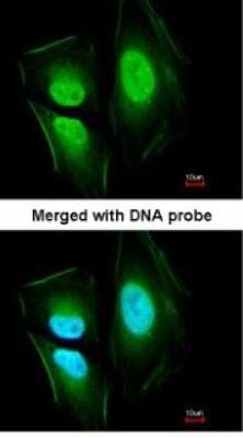 Immunocytochemistry/ Immunofluorescence: EFCAB14 Antibody [NBP1-33182]