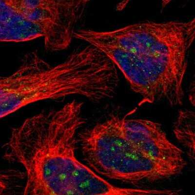 Immunocytochemistry/ Immunofluorescence: EFCAB14 Antibody [NBP1-86104]