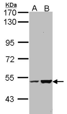 Western Blot: EFCAB14 Antibody [NBP1-33182]