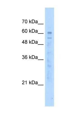 Western Blot: EFCAB14 Antibody [NBP1-59967]
