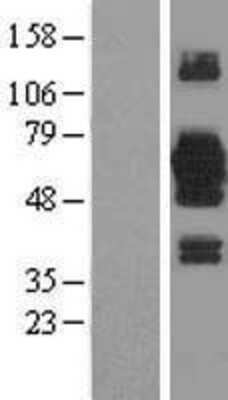 Western Blot: EFCAB14 Overexpression Lysate [NBL1-12248]