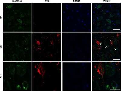 Immunocytochemistry/ Immunofluorescence: KIAA0556 Antibody [NBP1-91006]