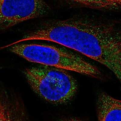 Immunocytochemistry/ Immunofluorescence: VWA8 Antibody [NBP2-30596]