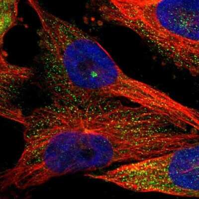 Immunocytochemistry/ Immunofluorescence: KIAA0753/MNR Antibody [NBP1-90929]