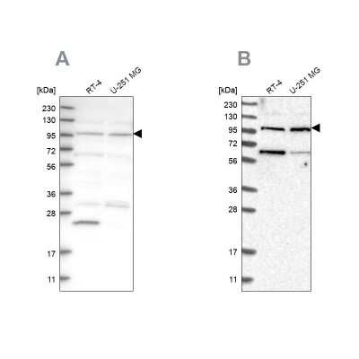 Western Blot: KIAA0753/MNR Antibody [NBP1-90929]
