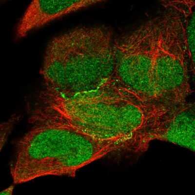 Immunocytochemistry/ Immunofluorescence: KIAA0895 Antibody [NBP2-57298]