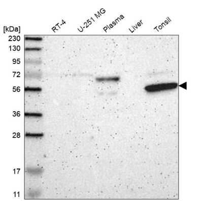 Western Blot: KHDC4 Antibody [NBP1-86485]