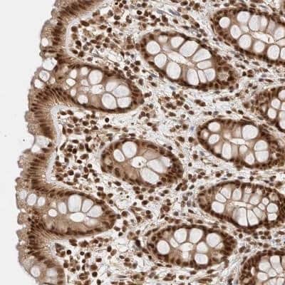 Immunohistochemistry-Paraffin: KIAA1107 Antibody [NBP1-87546]