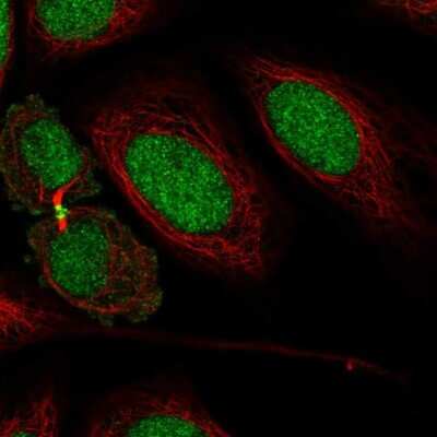 Immunocytochemistry/ Immunofluorescence: KIAA1143 Antibody [NBP2-57324]