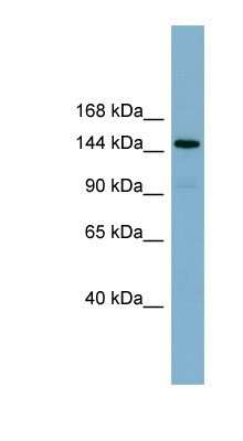 Western Blot: CEMIP/KIAA1199 Antibody [NBP1-58029]