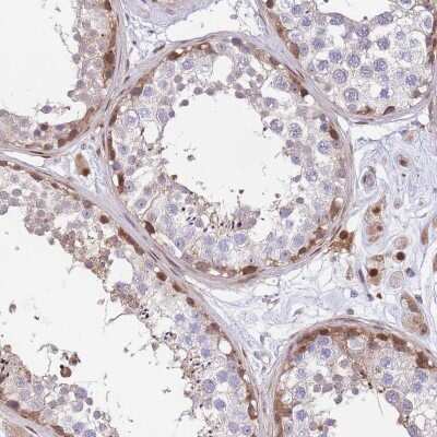 Immunohistochemistry-Paraffin: KIAA1211 Antibody [NBP2-30539]