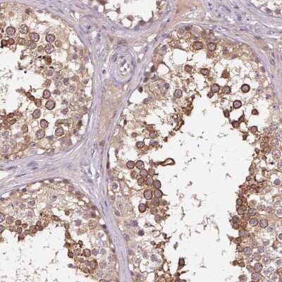 Immunohistochemistry: KIAA1257 Antibody [NBP2-38582]