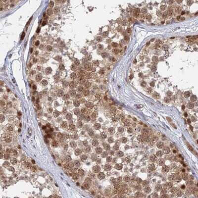 Immunohistochemistry-Paraffin: KIAA1257 Antibody [NBP2-14154]