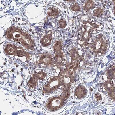 Immunohistochemistry-Paraffin: KIAA1328 Antibody [NBP1-90892]