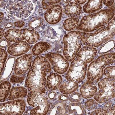 Immunohistochemistry-Paraffin: KIAA1468 Antibody [NBP1-93850]