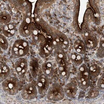 Immunohistochemistry-Paraffin: KIAA1522 Antibody [NBP1-90915]