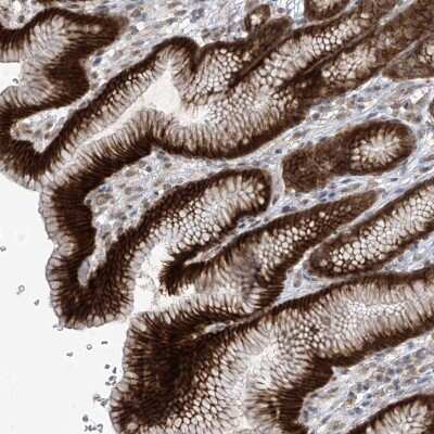 Immunohistochemistry-Paraffin: KIAA1522 Antibody [NBP2-58457]