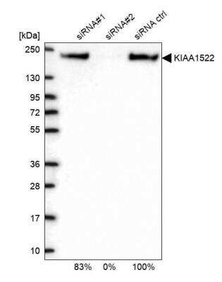 Western Blot: KIAA1522 Antibody [NBP2-58457]