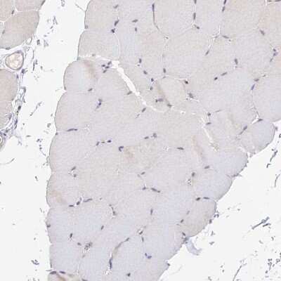 Immunohistochemistry-Paraffin: CAMSAP3 Antibody [NBP1-90961]
