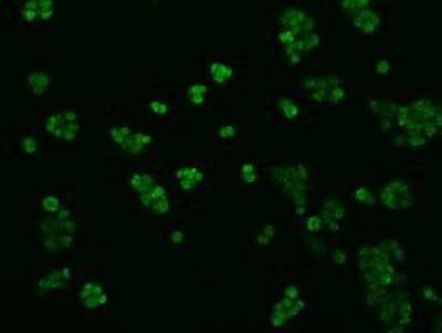 Immunocytochemistry/ Immunofluorescence: TLDC1 Antibody (OTI5D9) [NBP2-02352]