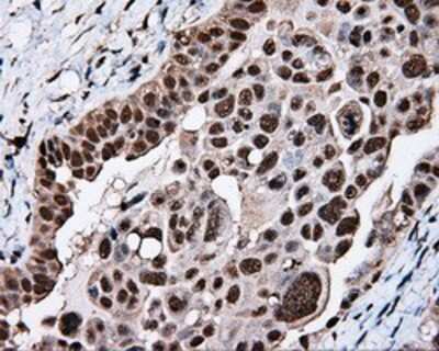 Immunohistochemistry-Paraffin: TLDC1 Antibody (OTI5D9) [NBP2-02352]