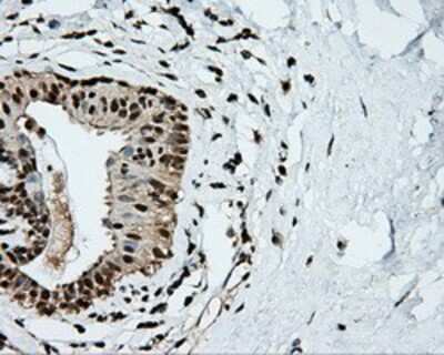 Immunohistochemistry-Paraffin: TLDC1 Antibody (OTI5D9) [NBP2-02352]