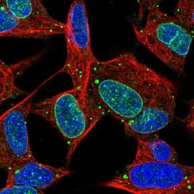 Immunocytochemistry/ Immunofluorescence: KIAA1614 Antibody [NBP2-56291]
