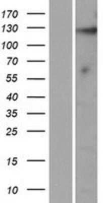 Western Blot: KIAA1614 Overexpression Lysate [NBP2-06580]