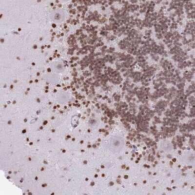 Immunohistochemistry-Paraffin: Shisa Like 1 Antibody [NBP2-14729]