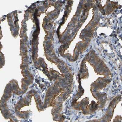 Immunohistochemistry-Paraffin: KIAA1671 Antibody [NBP1-91085]