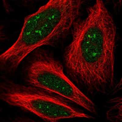 Immunocytochemistry/ Immunofluorescence: KIAA1841 Antibody [NBP2-14155]