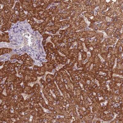 Immunohistochemistry-Paraffin: KIAA1841 Antibody [NBP2-14155]