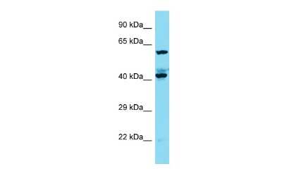 Western Blot: KIAA1841 Antibody [NBP2-85151]