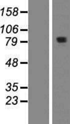 Western Blot: KIAA1841 Overexpression Lysate [NBP2-06011]