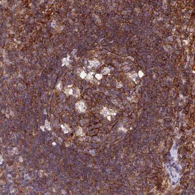Immunohistochemistry-Paraffin: PPP1R18 Antibody [NBP2-30801]