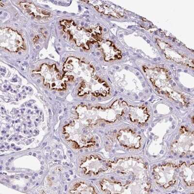 Immunohistochemistry: KIAA2013 Antibody [NBP2-30733]