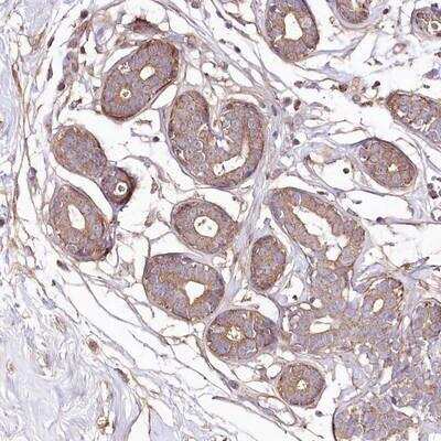 Immunohistochemistry: KIBRA Antibody [NBP1-92053]