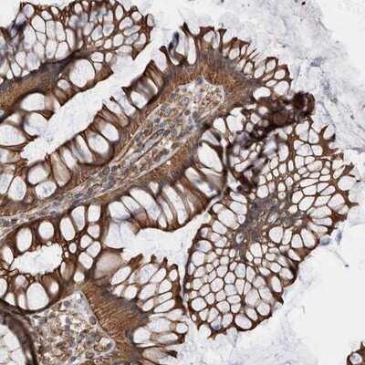Immunohistochemistry-Paraffin: KIF12 Antibody [NBP1-85984]