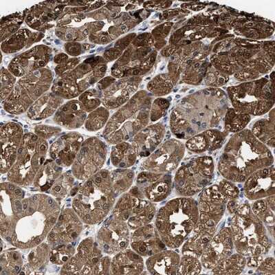 Immunohistochemistry-Paraffin: KIF12 Antibody [NBP1-86029]