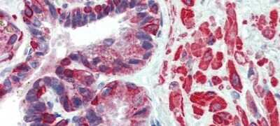 Immunohistochemistry: KIF13B Antibody [NBP1-58258]