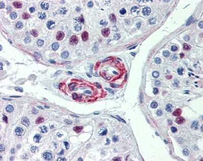 Immunohistochemistry-Paraffin: KIF13B Antibody [NBP1-58258]