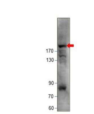 Western Blot: KIF14 Antibody [NBP3-12320]