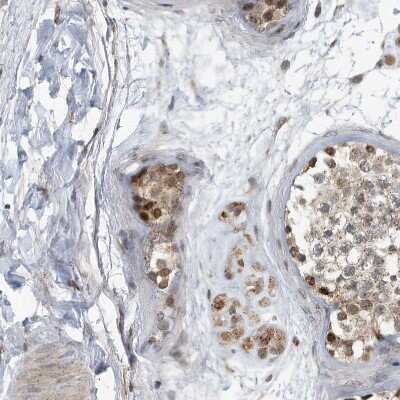Immunohistochemistry-Paraffin: KIF15 Antibody [NBP1-83252]