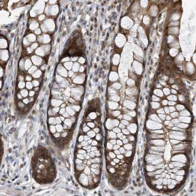 Immunohistochemistry-Paraffin: KIF15 Antibody [NBP1-83252]