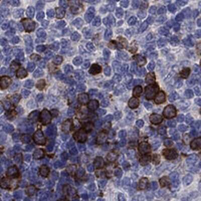 Immunohistochemistry-Paraffin: KIF15 Antibody [NBP3-17874]