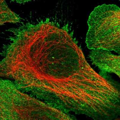 Immunocytochemistry/ Immunofluorescence: KIF17 Antibody [NBP1-81409]