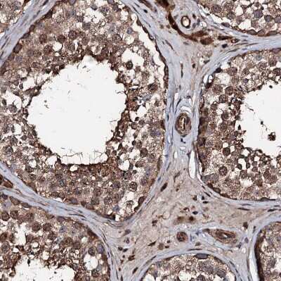 Immunohistochemistry-Paraffin: KIF18A Antibody [NBP1-85126]