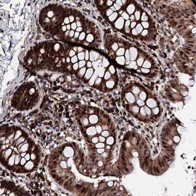 Immunohistochemistry-Paraffin: KIF18A Antibody [NBP1-85127]